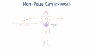 Non Polio Enteroviruses  Echovirus Coxsackievirus and Enterovirus [upl. by Anikram]