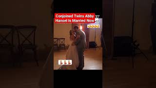 Abby Hensel One of the Conjoined Twins Gets Married viral abby trending [upl. by Randene]