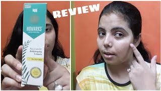 NOMARKS Ayurvedic Antimarks Cream Review  For Oily Skin  Good Product [upl. by Clover585]