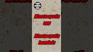 🤔Blastocystis Hominis en Heces Es un QuisteForma Vacuolar ¿Que es Morfologia e Identificacion🔬p2 [upl. by Eylrac]