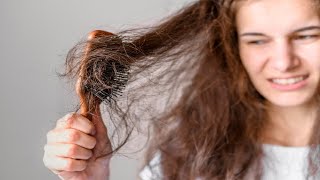 5 Home Remedies for Dry Hair That Will Transform Your Hair [upl. by Gilbertina822]