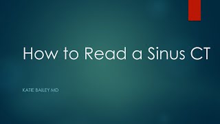 How to read a Sinus CT [upl. by Anicnarf]