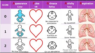 Apgar Score Assessment  newborn Apgar Score [upl. by Alayne]