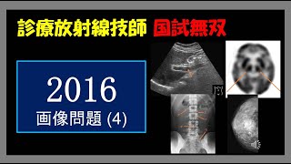 【診療放射線技師国家試験】 2016画像問題 4 [upl. by Naitsihc]