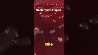 Bacteroides fragilis  Microbiology LabTech Healthcare InfectiousDiseases LaboratoryScience [upl. by Chamberlin]