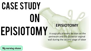 Case study on Episiotomy 👩‍⚕️✂️ its important project in obgcasestudy casepresentationnotes [upl. by Naneik]