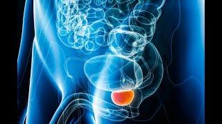 TESTICULAR TORSION Why  What are the reasons What are the symptoms health testicularcancer [upl. by Ajup]