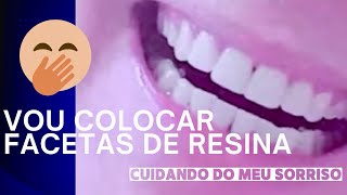 VOU COLOCAR FACETAS DE RESINA 😱 será que vou gostar [upl. by Mcnully289]