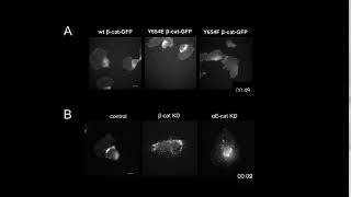 Role of Catenins in Cell Migration [upl. by Nama192]