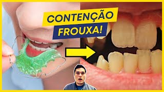 CONTENÇÃO ORTODÔNTICA FROUXA OU APERTADA ISSO É NORMAL O QUE FAZER [upl. by Ycal]