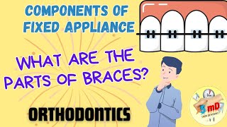 Components of Fixed Appliance  ORTHODONTICS  Easy noteswith pictures to remember [upl. by Owen]