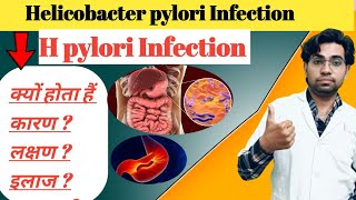 helicobacter pylori tratament  how to treat h pylori bacteria  h pylori treatment side effects [upl. by Nnarefinnej]