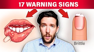 17 WARNING Signs Your Body Needs More Nutrients [upl. by Hamlet]