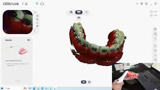 Intraoral Scanners For Dental Office [upl. by Clie792]