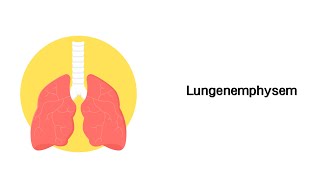 Lungenemphysem  Erkrankungen der Atemwege [upl. by Yelrebmik]