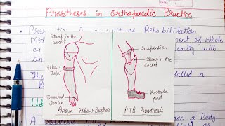 Prosthesis in Orthopaedic Practice  uses parts of prosthesis [upl. by Aisinut202]