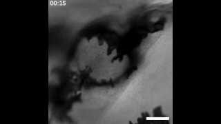 Melanocyte movement over an implanted bead 24 hours postwounding [upl. by Hiamerej]