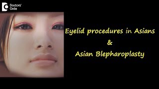 Eyelid procedures in AsiansAsian Blepharoplasty  Dr Ashok BC [upl. by Arrio]