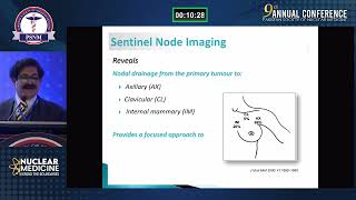 PSNM 2024  Sentinal Node Imaging and Biopsy in Breast Cancer  Qaiser Siraj [upl. by Zetes]