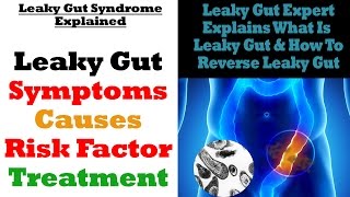 Leaky Gut Causes Symptoms Risk Factors amp How To Reverse Leaky Gut [upl. by Blair907]