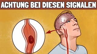 Vor einem Schlaganfall sendet dir dein Körper diese Signale [upl. by Donavon217]