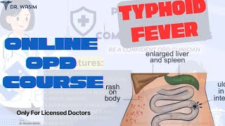 OPD Case 17 Typhoid Fever  Enteric Fever  Pocket Primer for Common OPD Cases  For Doctors Only [upl. by Enileuqcaj64]