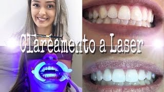 Clareamento Dental a Laser [upl. by Enyawal181]