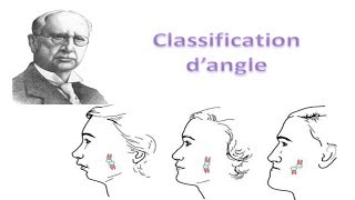 Classification dangle des malocclusions en Orthodontie [upl. by Qiratla]