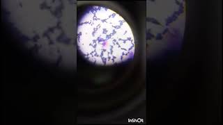 Candida albicans 100x oil immersion [upl. by Ekoorb]