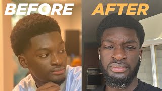 How to Grow a Full Beard in 6 Months  My Proven Beard Growth Journey [upl. by Barbabas]