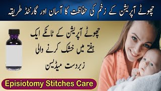 Chota Operation Recovery In Urdu  सामान्य प्रसव के टांके की घर पर देखभाल  Episiotomy Stitches Care [upl. by Akienat]