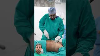 Gynecomastia Surgery 😳🩺 dezireplasticsurgerycenter plasticsurgerycenter doctor shortsfeed [upl. by Rramahs]