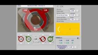 Retinoscopy Simulator Tutorial  Retinoscopy part 2 [upl. by Oecile]