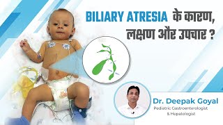 Biliary Atresia के कारण लक्षण और उपचार  Biliary Atresia Baby  Dr Deepak Goyal [upl. by Aknayirp]