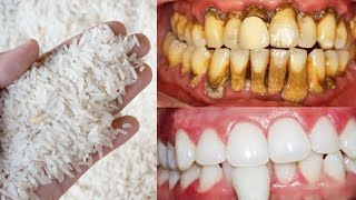 how to whiten your teeth naturally in 1 minute you will have teeth as white as pearls [upl. by Akemor]