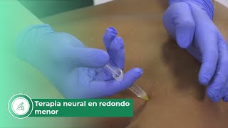 Terapia neural en redondo menor [upl. by Farrow]