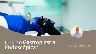 O que é Gastroplastia Endoscópica  Prof Dr Luiz Carneiro CRM 22761 [upl. by Geiss]