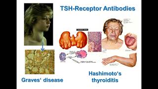 TSH Receptor Antibodies Nomenclature Functionality and Assay Comparison [upl. by Arrais]