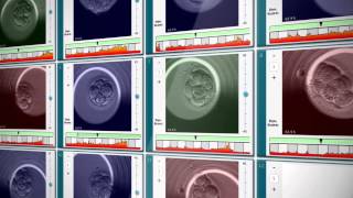 EmbryoScope® Timelapse System [upl. by Hsivat]