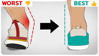 The Best Shoes to Fix Overpronation Fallen Arches [upl. by Lipscomb172]