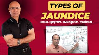 Types Of Jaundice  Causes Symptoms amp Treatment  Dr Najeeb [upl. by Tterej]