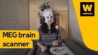 Designing a new brain scanner MEG  Wellcome [upl. by Robena]