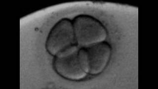 Rotation of the blastomeres at 4cells human embryoavi [upl. by Olodort]