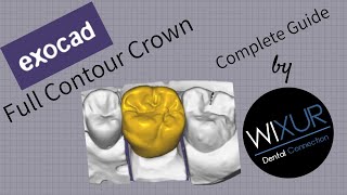 Exocad  Full Contour Crown Design [upl. by Prince]