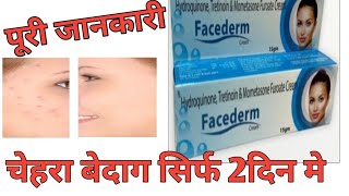 Hydroquinone Tretinoin amp Mometasone Furoate Cream Review by Guru Kirpa Clinic [upl. by Vickey]