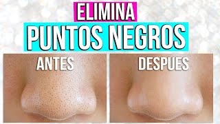 ELIMINA PUNTOS NEGROS EN MINUTOS ❤️ MASCARILLA PEEL OFF CASERA DE GELATINA  Tutoriales Belen [upl. by Teragramyram651]