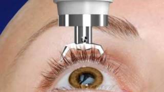 Unique DIATON Tonometry Through Eyelid  with Diaton Tonometer  Introduction  Description Part1 [upl. by Idonna]