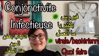 Conjonctivite infectieuse التهاب الملتحمةالعين المعدي [upl. by Long445]