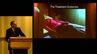 quotCase Study Cervical Dystonia Resolution with Somatosensory Therapyquot  Kevin Lasko DC [upl. by Osugi731]