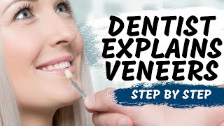 Porcelain Veneers Procedure Explained [upl. by Shanleigh]